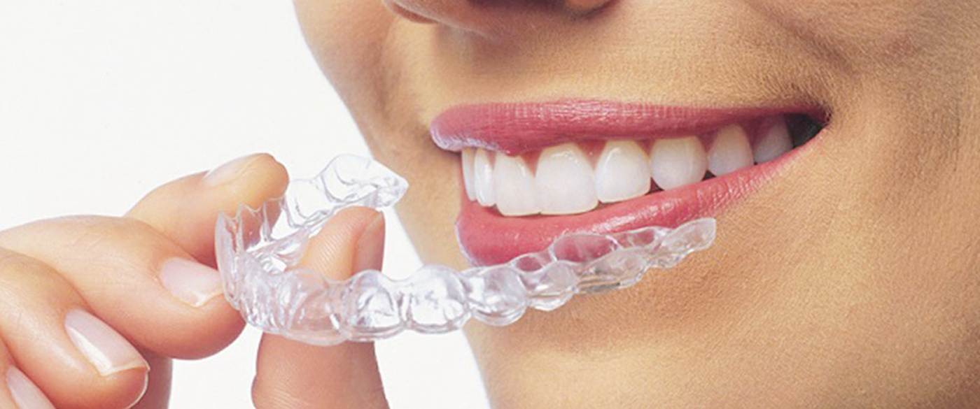 Mascherine dentali trasparenti - Dental Competence Grosseto